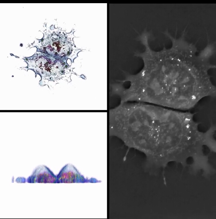Read more about the article Stem cells 3D digital staining