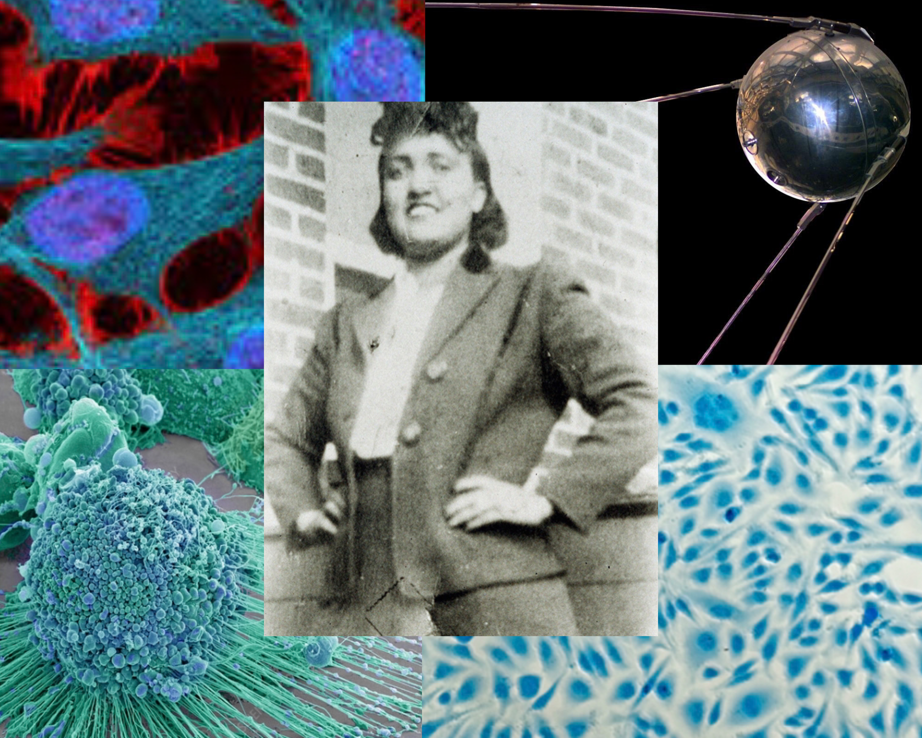 Read more about the article Immortal Cells of Henrietta Lacks/HeLa